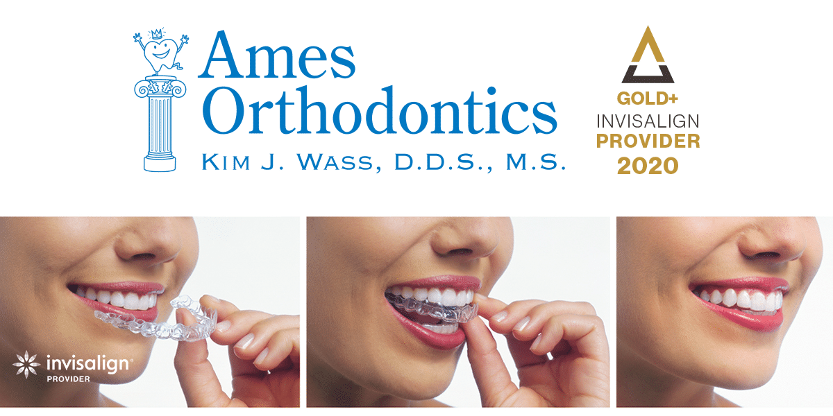 Invisalign® clear aligner